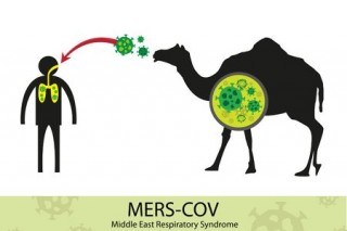 UAE national suspected of having MERS