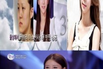 렛미인 방미정 근황 “성형했던 병원 코디네이터로 근무, 여전히 놀라운 미모”