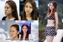 ‘렛미인’ 방미정, 양악수술 받은 병원서 고객상담하며… “역대 최고 미인”