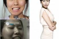 렛미인 삐뚤어진 엄마 ‘최근 근황 보니…’