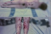 ‘그것이 알고싶다’ 동화의 집…“피부 도려내고 싶을 정도로 가려웠을 것”