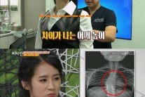 완벽 몸매 박기량…20대에 관절염 소견 깜짝