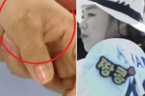 ‘양궁 2관왕’ 장혜진, 굳은살 박힌 손…“관절염도 있다”
