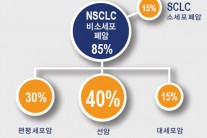 아시안 아메리칸 암 사망 1위 폐암 초기 진단과 바이오마커 검사..