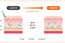 365mc 지방줄기세포센터, “지방제거, 미래 건강을 준비하는 자산으로 재탄생”