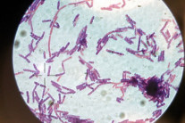 한국,탄저백신 자체 개발…비축량 획기적 확대 가능