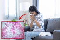 “독감인 줄 알았더니 24시간 내 사망?” 공포 그 자체…끔찍한 ‘빨간색 세균’