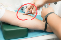 “이건 진짜 충격이다” 피검사로 3년 일찍 ‘암’ 진단…전 세계 발칵 뒤집혔다