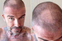 “끔찍하다”…베컴 머리에 ‘땜빵’ 대참사, 무슨일?