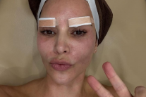 할리우드 셀럽 킴 카다시안 한국서 피부 시술받아