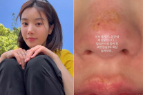 “놀라셨죠” 킬리만자로 간 권은비, 2도 화상…‘의외의’ 원인