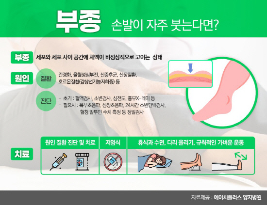 201027_H+양지병원_10월_새농사칼럼_이미지_부종