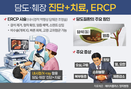 0209_ERCP